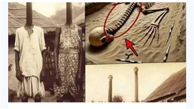 قصه خوخا الذى أطلق عليه الزرافه