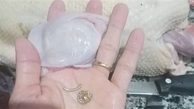 حلق بنتي