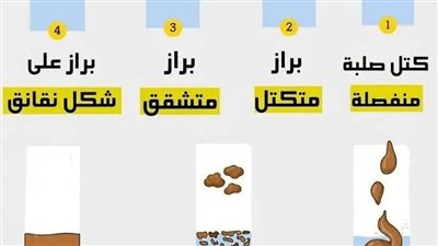 كتل صلبة منفصلة إمساك شديد