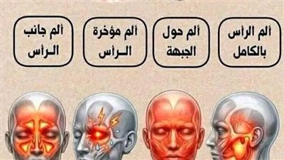 ألم الرأس بالكامل : يثار بسبب الأطفال يومياً  ألم حول الجبهة : بسبب شعور …