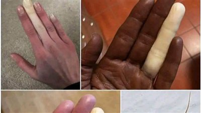 احذر مليون مرة قبل ملامسة هذه الحشره